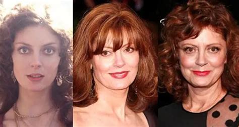 Susan Sarandon Plastic Surgery Before And After Celebie