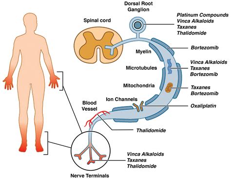 A Comparative Review Of Chemotherapy Induced Peripheral Neuropathy In