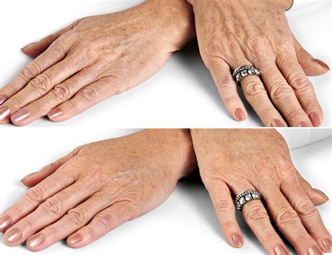 do your hands give away your age be skin smart