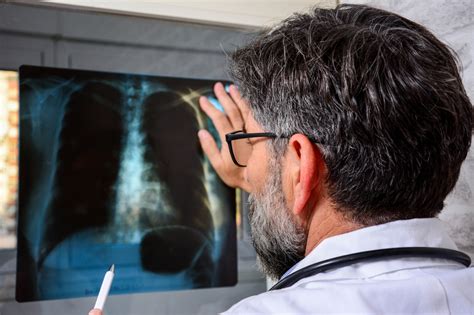 Radiology Expert Witness Elite Medical Experts