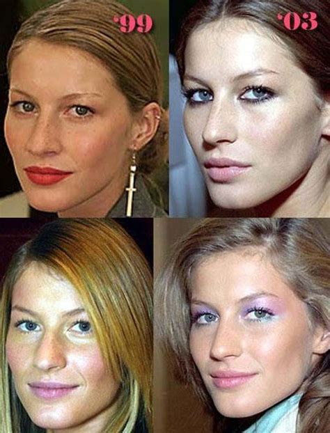 Celebrity Nose Jobs Before And After Celebrity Plastic Surgery Hair