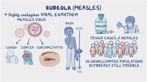Rubeola Measles Nursing Osmosis Video Library