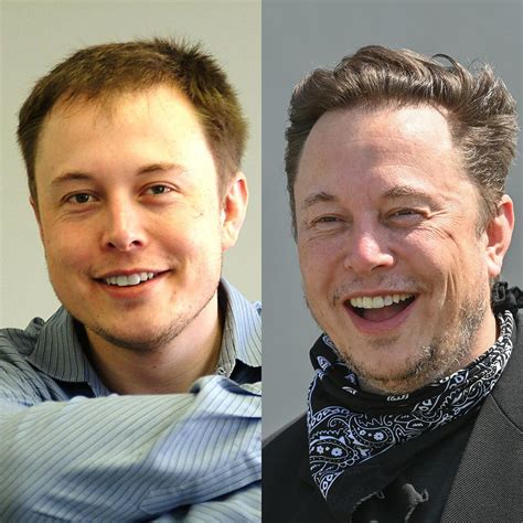 Elon Musk Schönheits-OP: „Beste Entscheidung!“ 👀 | BRAVO