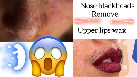 Upper Lips Wax Blackheads Remove Nose Hair Remove By Upper Lips