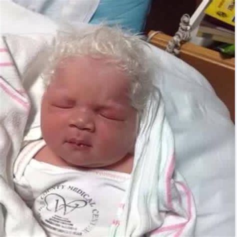 Baby Born With White Hair Galhairs