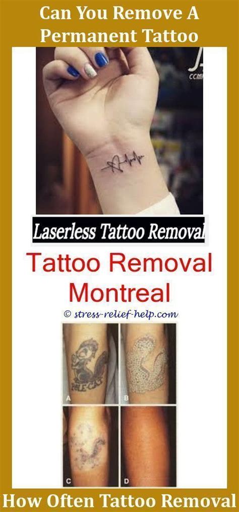 Our laser hair removal melbourne cbd pricing depends on the area that is being treated and the size of the treatment area. Tattoo Removal Cost Does Laser Hair Removal Mess Up ...
