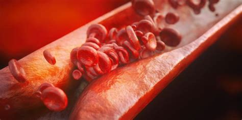 Darah tinggi tidak boleh diabaikan karena darah tinggi boisa menyebabkan berbagai macam gangguan kesehatan. Ini 11 Punca Darah Tinggi Yang Selalu Orang Tak Sedar ...