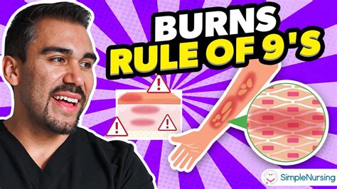 Burns Nursing Overview Rule Of Nines Types Causes Care All About