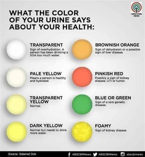 What The Color Of Your Urine Says About Your Health Infographic Kinnaka S Blog
