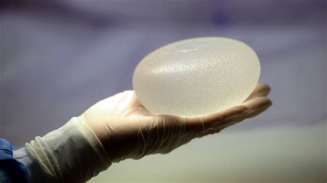 More Cases Are Reported Of Unusual Cancer Linked To Breast Implants The New York Times