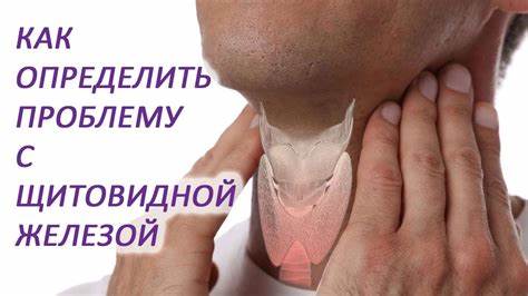 Как определить проблему с щитовидной железой / Другая медицина /Доктор Картинка - Как определить проблему с щитовидной железой / Другая медицина /Доктор
