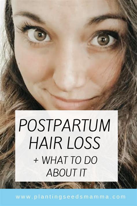 Postpartum Hair Loss And What To Do About It Planting Seeds Mamma