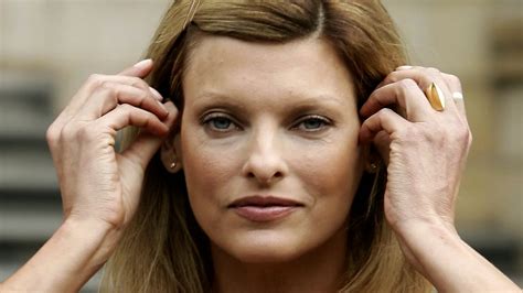 Linda Evangelista Claims Shes Permanently Deformed Following