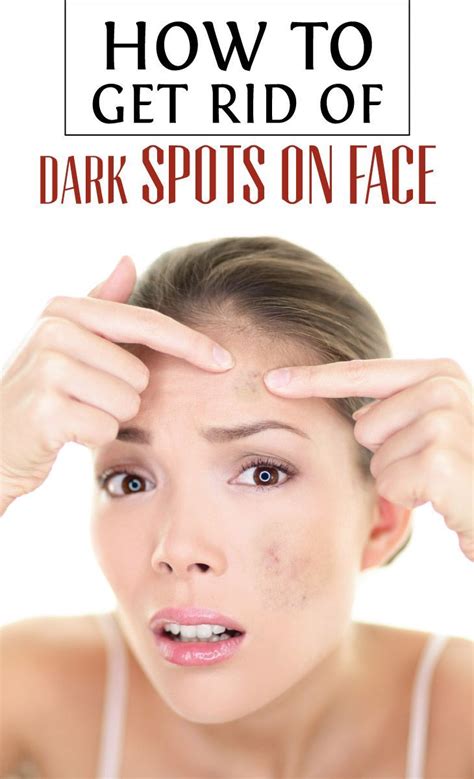 How To Get Rid Of Dark Spots On Face Dark Spots On Face Brown Spots