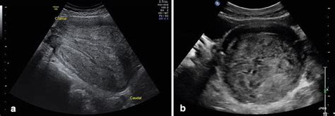 transabdominal b mode sonography a sagittal plane with mirror image of download scientific