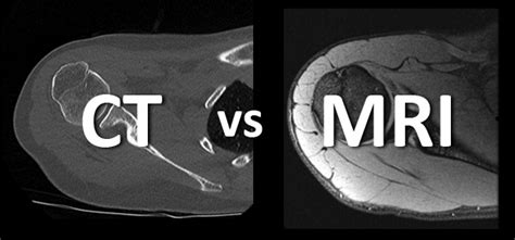 Whats The Difference Between An Mri And Ct Cincinnati Childrens Blog