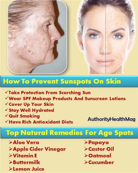 What suspicious changes in my skin should i look for? Sunspots On Skin And Face | Sunspot Removal Remedies