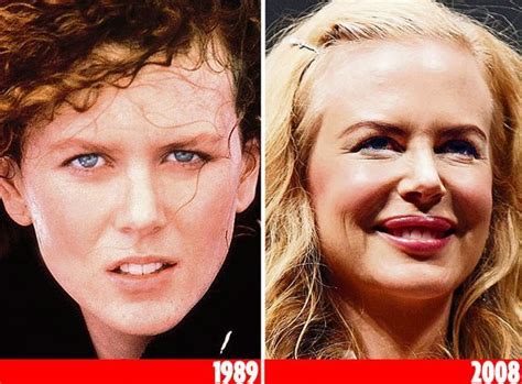 Which Celebrities Have Had Cosmetic Surgery Celebrity Plastic