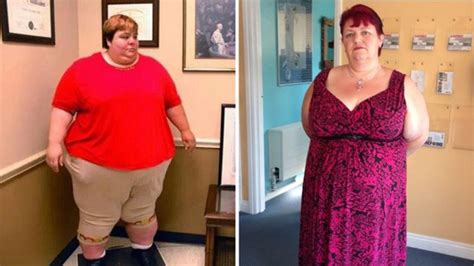 Victim Of Fat Shaming Loses 25 Stone After Surgery Bbc News