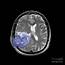 Malignant Brain Tumor 1 Of 3 Photograph By Living Art Enterprises