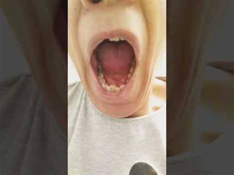 Asmr Yawn Dangle Uvula Girl On What Does Your Uvula Do Youtube