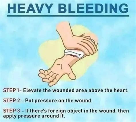 Steps To Stop Bleeding Medizzy
