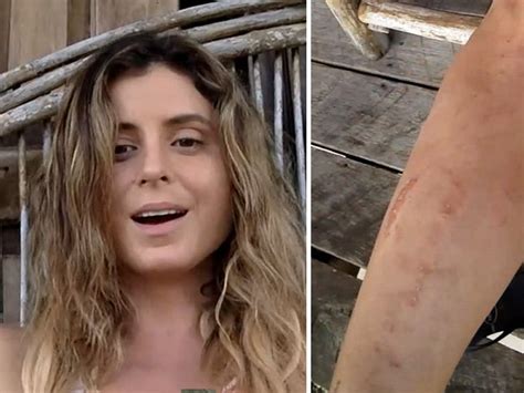 Anastasia Ashley Naked And Attacked By Sandflies Video Photo