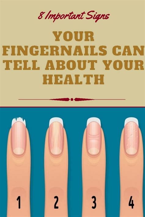 8 Important Signs Your Fingernails Can Tell About Your Health In 2020
