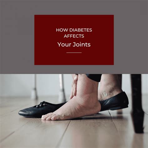How Diabetes Affects Your Joints Orthopaedic Institute Of Henderson Orthopedic Surgery