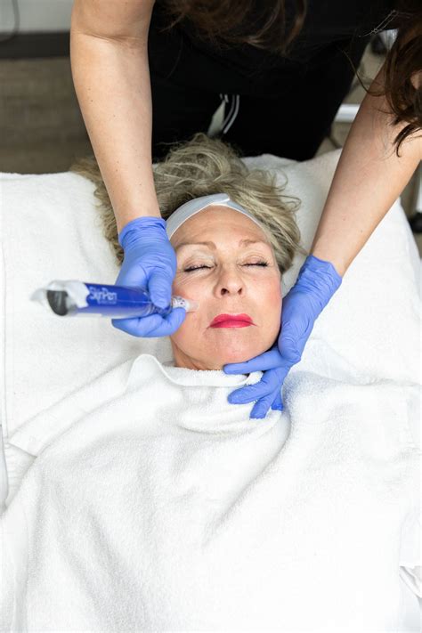 Microneedling In Rogers With Skinpen Renew Aesthetics Medical Spa