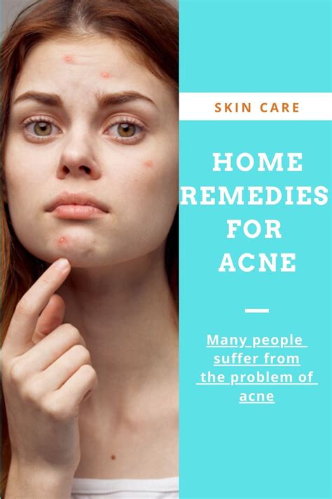 Home Remedies For Acne Acne Skin Care Face Care Home Remedies For
