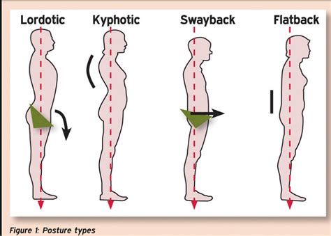 Posture Physiopedia