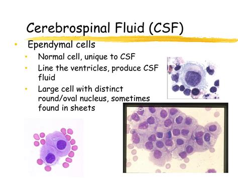 Ppt Urinalysis And Body Fluids Crg Powerpoint Presentation Free