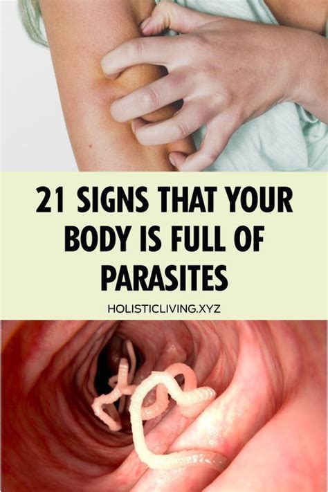 21 Signs That Your Body Is Full Of Parasites Intestinal Parasites Health Parasite
