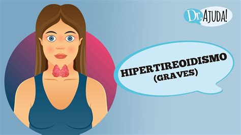 Hipertireoidismo O Que Sintomas E Tratamento Youtube