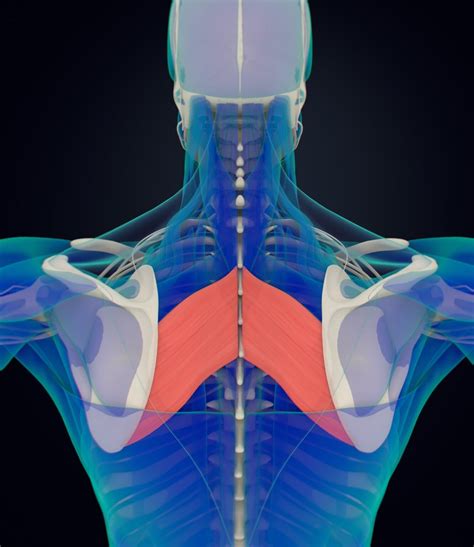 Chronic Rhomboid Pain Muscle Pain