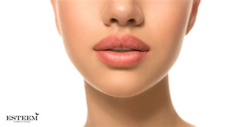 lip augmentation from 380 per ml esteem sydney and canberra