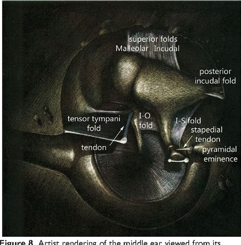 Figure 1 From Endoscopic Anatomy Of The Pediatric Middle Ear Semantic