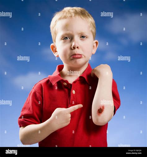 Boy With Scraped Elbow Stock Photo Alamy