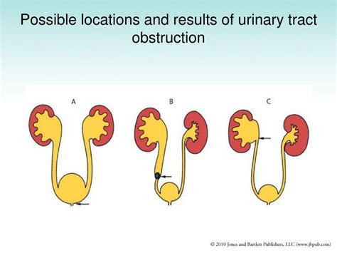 Ppt The Urinary System Powerpoint Presentation Free Download Id