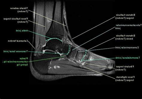 The purpose of this unit study on bones and muscles is to help students learn and understand the function and purpose of the bones and muscles in the body. MRI Ankle Anatomy | Ankle anatomy, Foot anatomy, Anatomy