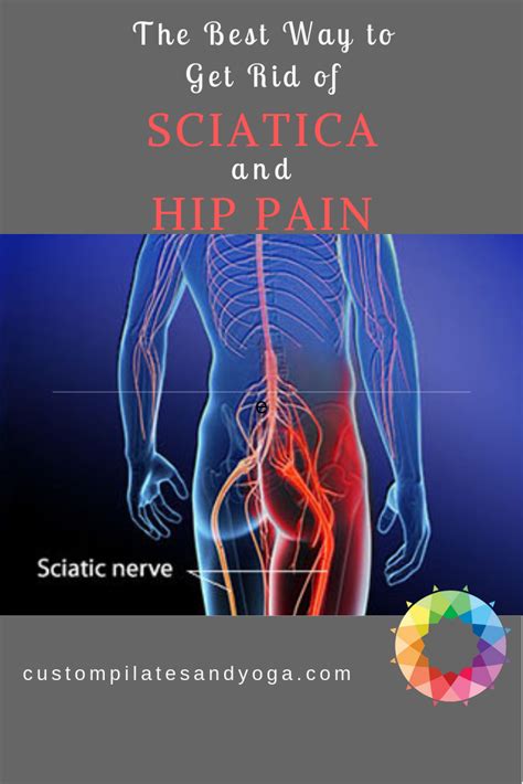 Sciatica And Hip Pain Are Often Tied Together Because Both Can Be