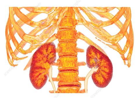 Kidneys And Spine And Ribs 3d Ct Scan Stock Image C0374588