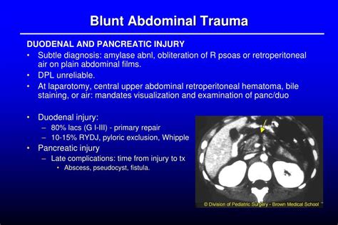 Ppt Abdominal Trauma Powerpoint Presentation Free Download Id3289814