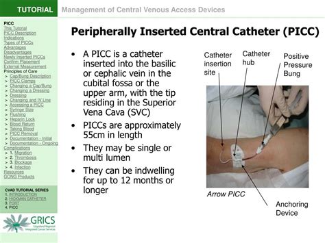 Ppt 4 Peripherally Inserted Central Catheter Picc Powerpoint