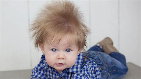 Some might have them and other may not. Baby's wild hair is the mane event Video - ABC News