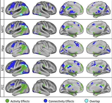 Overlap Map Of Recollection Related Activity And Connectivity Effects