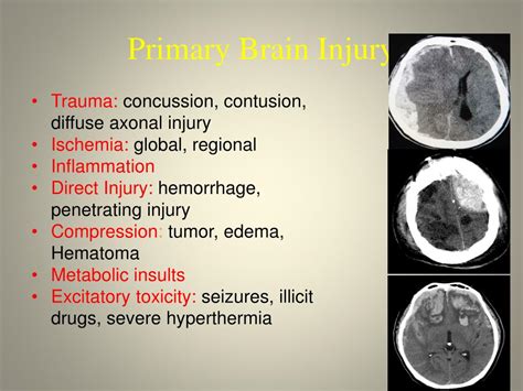 Ppt Traumatic Brain Injury Powerpoint Presentation Free Download