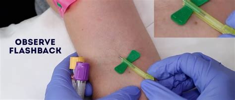 Venepuncture Procedure Osce How To Take Blood Geeky Medics