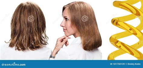 Hair Before And After Treatment By Oil Therapy Stock Image Image Of
